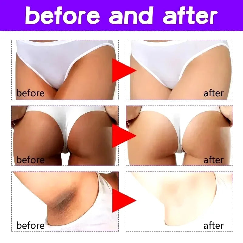 Brighten Cream Face Care Bleaching Armpits Elbows Knees Moisturizing Body Lotion Cream Brightening Lightening Melanin Skin Cream