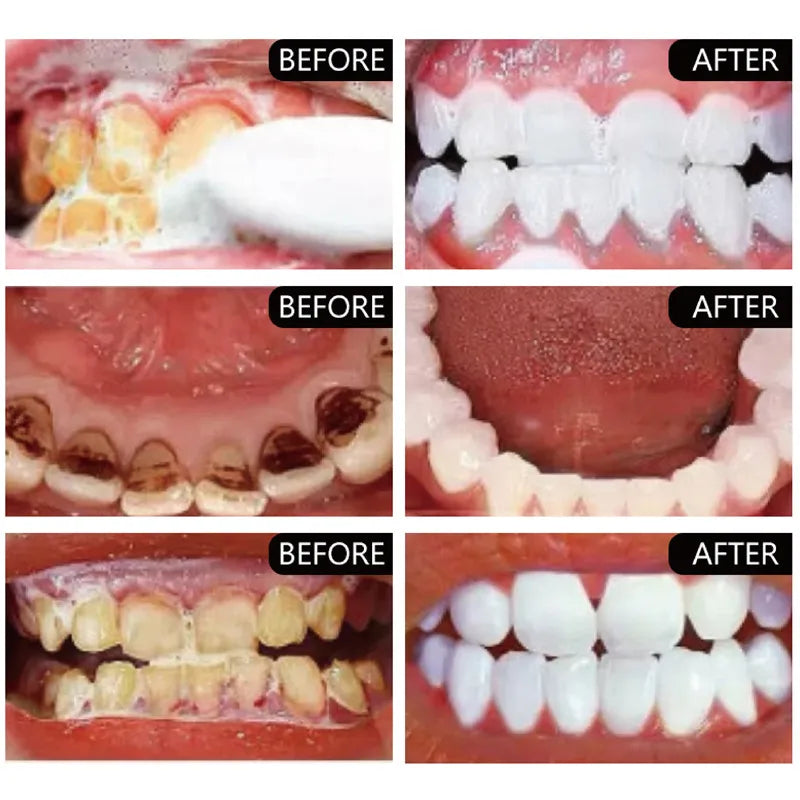 100g Probiotic Toothpaste Lemon Mint Whitening Tooth Remove Plaque Stains Teeth Whitener Oral Hygiene Clean Fresh Breath Dental