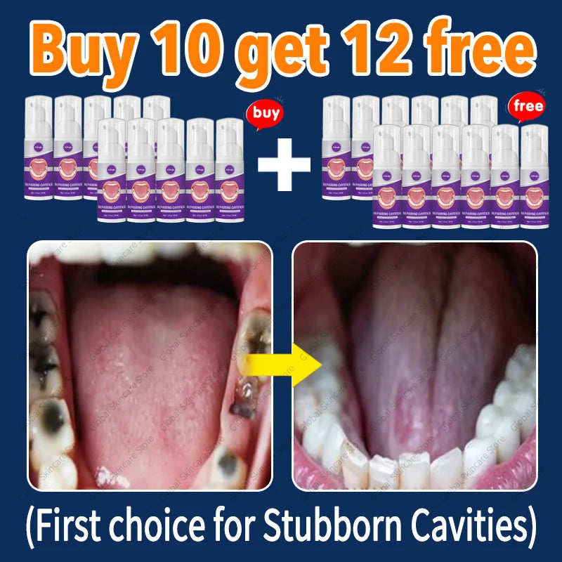 decay Tooth Repair Repairing Cavities Protect Anti caries