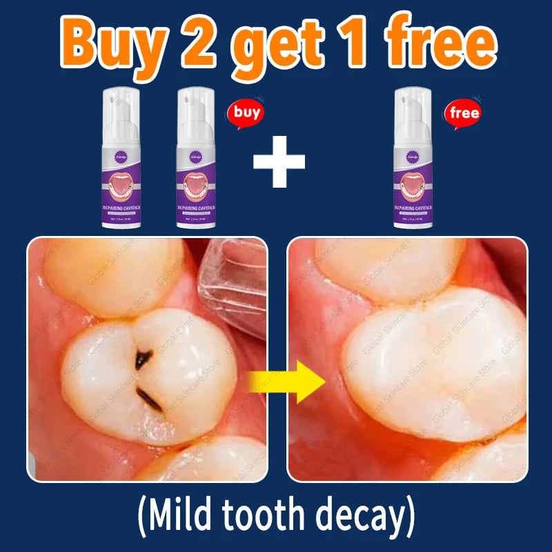 decay Tooth Repair Repairing Cavities Protect Anti caries