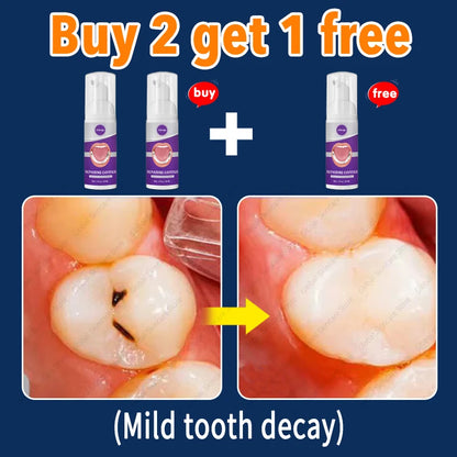 decay Tooth Repair Repairing Cavities Protect Anti caries