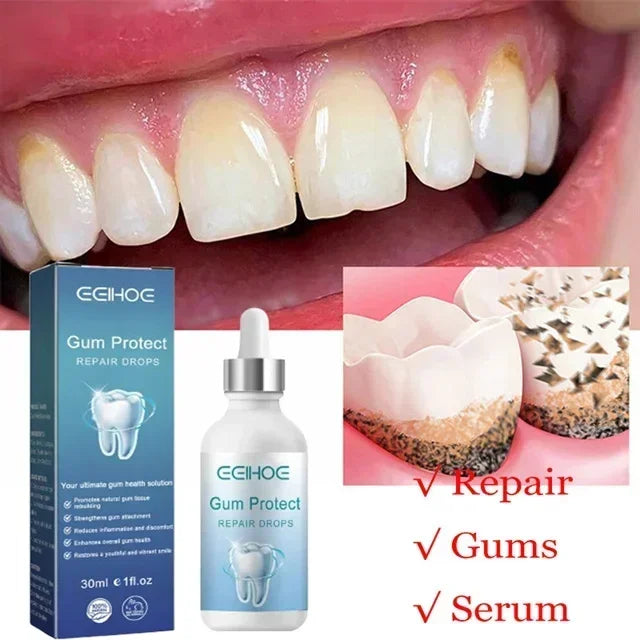 Suero Reparador Rápido para Encías, Alivia Efectivamente la Sensibilidad Dental, Caries, Limpieza Dental, Pasta Dental, Gotas para Aliviar el Daño Dental