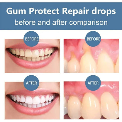 Suero Reparador Rápido para Encías, Alivia Efectivamente la Sensibilidad Dental, Caries, Limpieza Dental, Pasta Dental, Gotas para Aliviar el Daño Dental