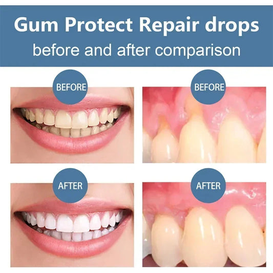 Suero Reparador Rápido para Encías, Alivia Efectivamente la Sensibilidad Dental, Caries, Limpieza Dental, Pasta Dental, Gotas para Aliviar el Daño Dental