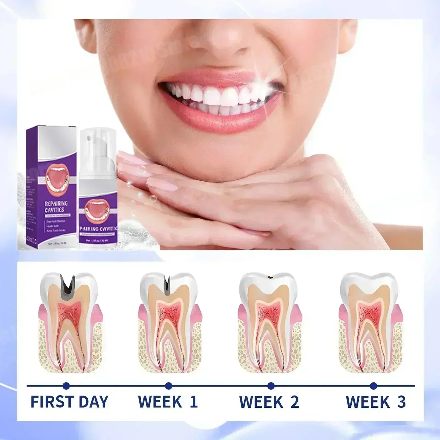 2025 Reparación de caries, todas las caries, caries y protegen los dientes Corrección del color