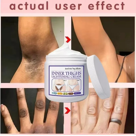 Brighten Cream Face Care Bleaching Armpits Elbows Knees Moisturizing Body Lotion Cream Brightening Lightening Melanin Skin Cream