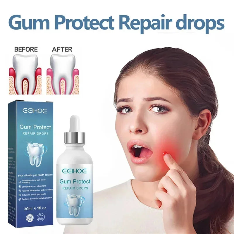 Suero Reparador Rápido para Encías, Alivia Efectivamente la Sensibilidad Dental, Caries, Limpieza Dental, Pasta Dental, Gotas para Aliviar el Daño Dental