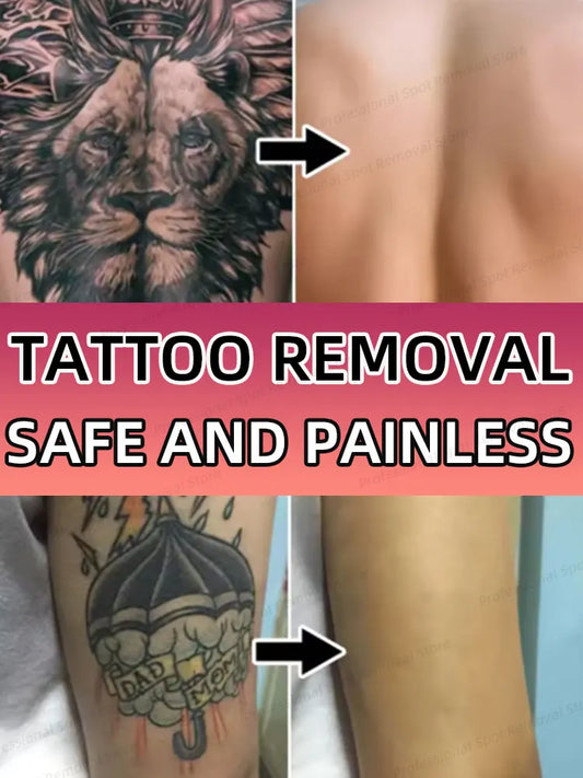 For the removal of colored permanent makeup tattoos, fast tattoo removal cream, text tattoo removal, pattern tattoo removal
