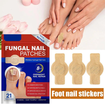 Fungal Nail Patches 21pcs Gently Repair Nails Ingrown Correction Sticker Discolored Damaged Nail Foot Care Tool