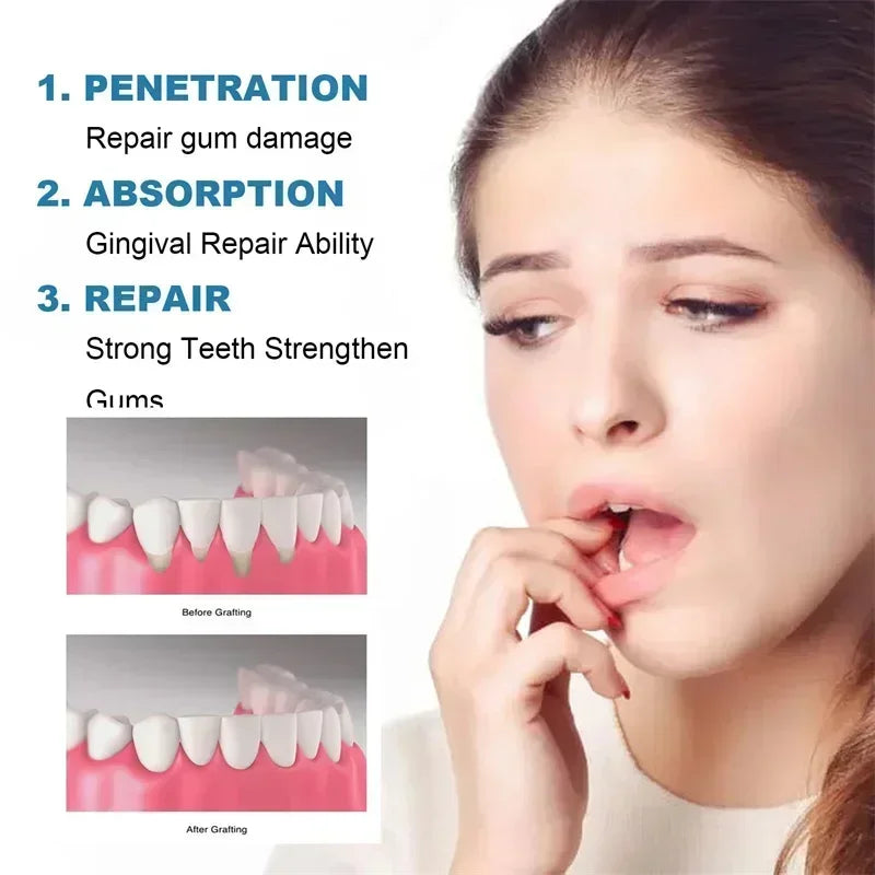 Suero Reparador Rápido para Encías, Alivia Efectivamente la Sensibilidad Dental, Caries, Limpieza Dental, Pasta Dental, Gotas para Aliviar el Daño Dental