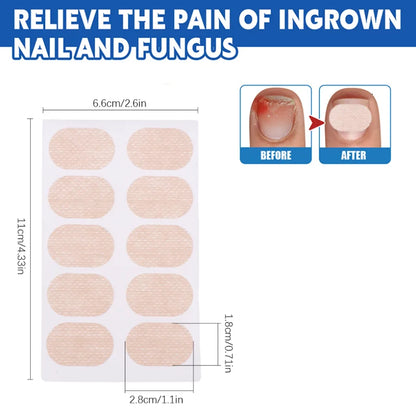 32/10PCS Paronychia Treatment Patch Fungus Removal Nail Ingrown Correction Stickers Nails Recover Pedicure Tools Care Health