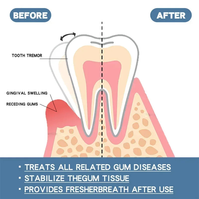 Suero Reparador Rápido para Encías, Alivia Efectivamente la Sensibilidad Dental, Caries, Limpieza Dental, Pasta Dental, Gotas para Aliviar el Daño Dental