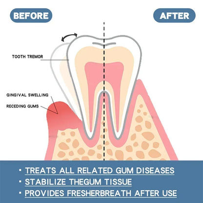 Suero Reparador Rápido para Encías, Alivia Efectivamente la Sensibilidad Dental, Caries, Limpieza Dental, Pasta Dental, Gotas para Aliviar el Daño Dental